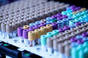 Read more about the article Total Calcium 검사 정상 수치, 높을 때·낮을 때 원인 및 뼈 건강 지표