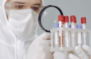 Read more about the article 췌장소도세포 항체 (ICA) 검사: 1형 당뇨를 확진하는 면역 지표