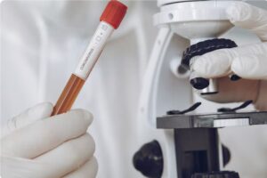 Read more about the article ALP 검사 정상수치, 높을 때·낮을 때 원인 완전 정리