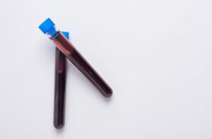 Read more about the article HOMA-IR 인슐린 저항성 검사 수치 해석과 개선 방법