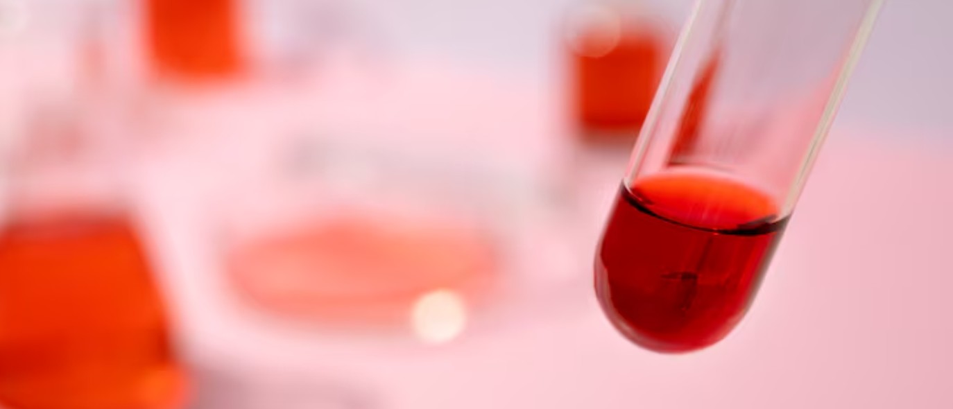 Read more about the article TBPE 검사 수치 해석 및 위양성 주의사항 가이드