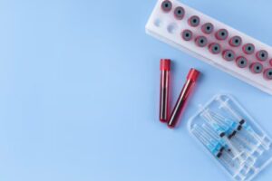 Read more about the article Troponin T 검사 수치 해석 및 심근경색 진단 가이드