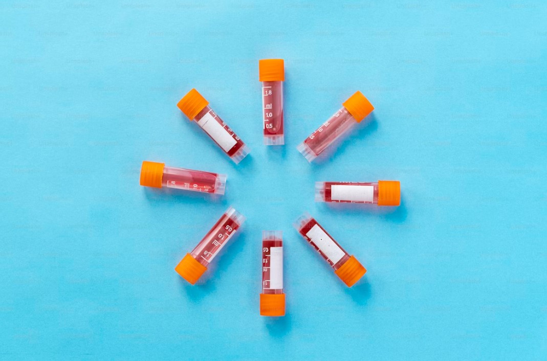 Read more about the article Magnesium 검사 높을 때, 낮을 때 원인과 관리법