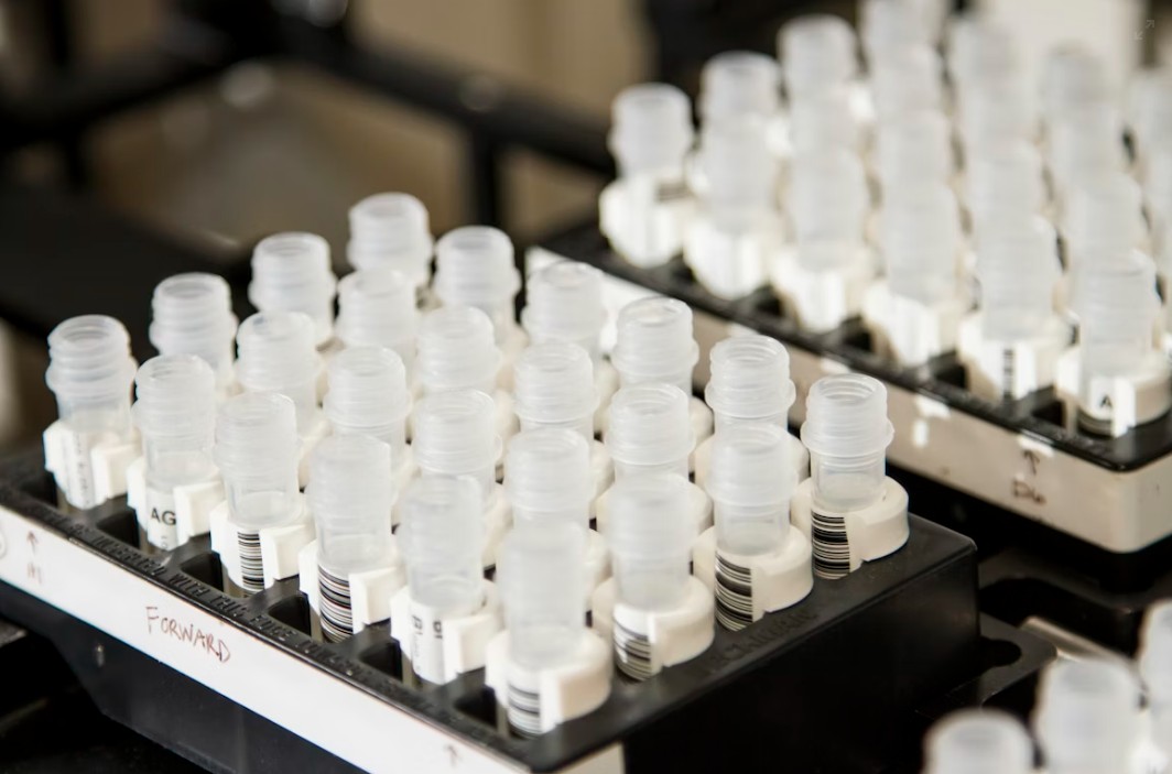 Read more about the article Osmolality 검사 정상 수치, 높을 때·낮을 때 원인 및 수분 균형 평가