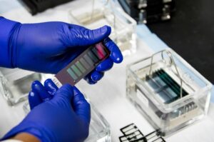 Read more about the article Iron 검사 정상 수치, 높을 때·낮을 때 원인 및 빈혈 진단 가이드