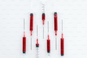 Read more about the article C4 보체 검사 수치 완벽 판독: 정상 범위와 수치 저하 시 의심되는 질환