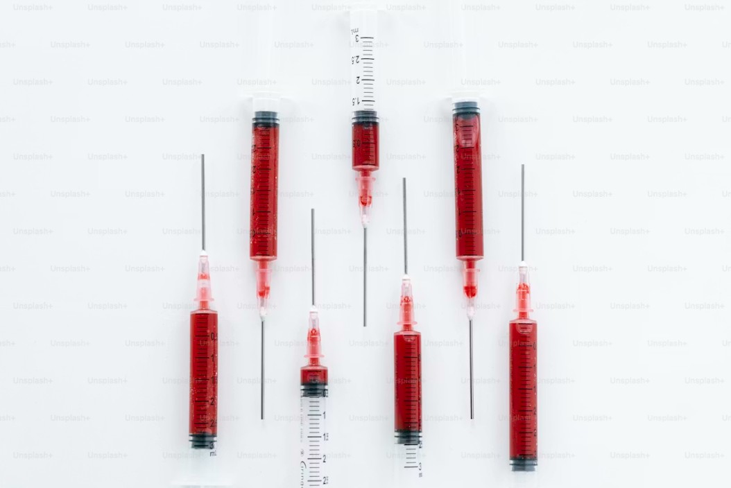 Read more about the article C4 보체 검사 수치 완벽 판독: 정상 범위와 수치 저하 시 의심되는 질환