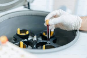 Read more about the article CH50 검사 완벽 가이드 정상 범위와 보체 수치 낮을 때 원인 및 증상