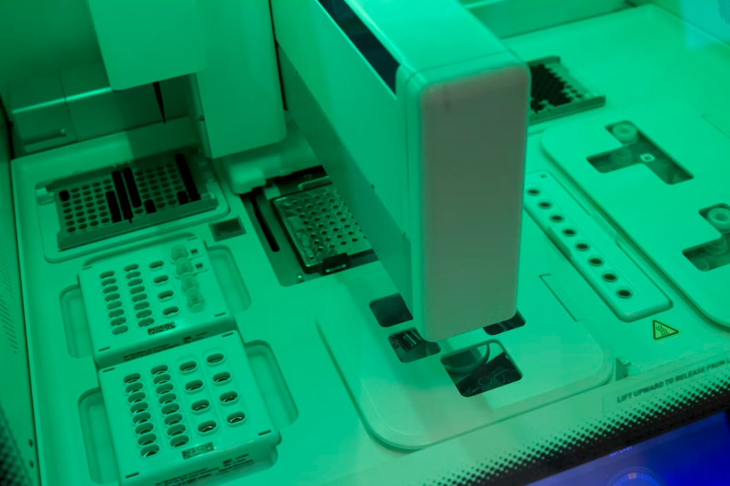 Read more about the article Glucose 검사 결과 해석: 정상 범위와 당뇨 진단 기준, 낮추는 음식