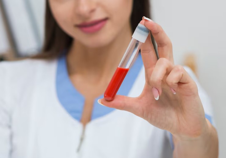 Read more about the article HbA1c 검사 해석 높을 때와 낮을 때의 음식 및 주의사항