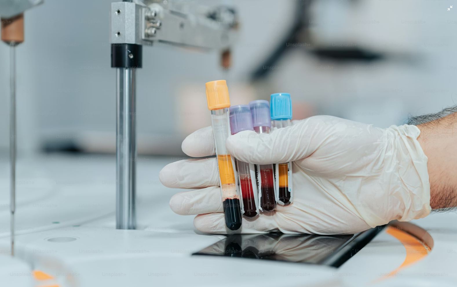 Read more about the article AIT 정밀 분석 자가면역 항원 패널 검사와 결과 판독