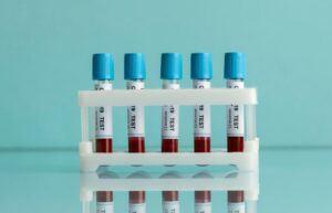 Read more about the article Anti-HDV(D형 간염 항체) 검사 B형 간염과의 동시 감염 위험성