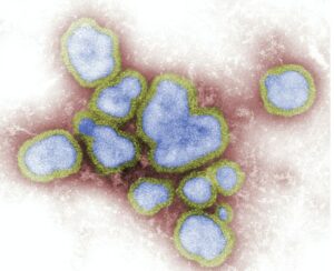 Read more about the article HAV IgG와 HBs Ab의 차이점 및 판독 가이드