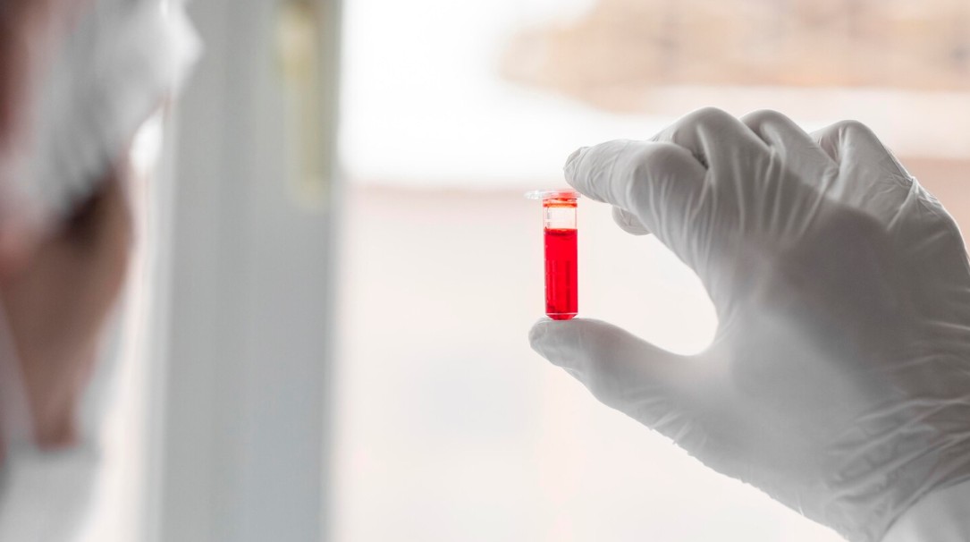 You are currently viewing SCC Ag(편평세포암 항원) 검사 정상 수치와 암표지자의 의미