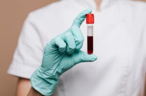 Read more about the article aPTT 검사 수치 상승·저하 의미와 내인성 응고 경로 분석