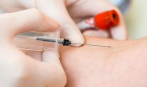 Read more about the article Antithrombin III (AT III) 검사 수치 해석과 혈전증 위험 분석