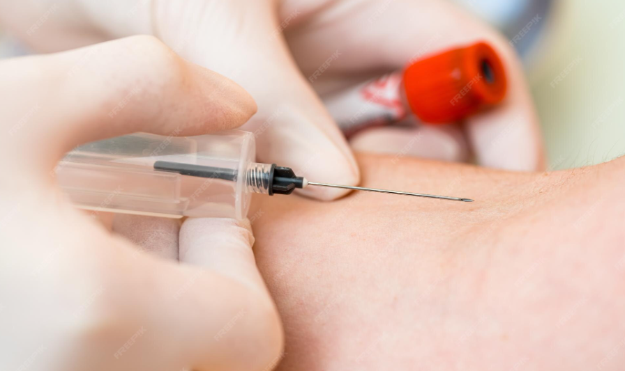 You are currently viewing Antithrombin III (AT III) 검사 수치 해석과 혈전증 위험 분석