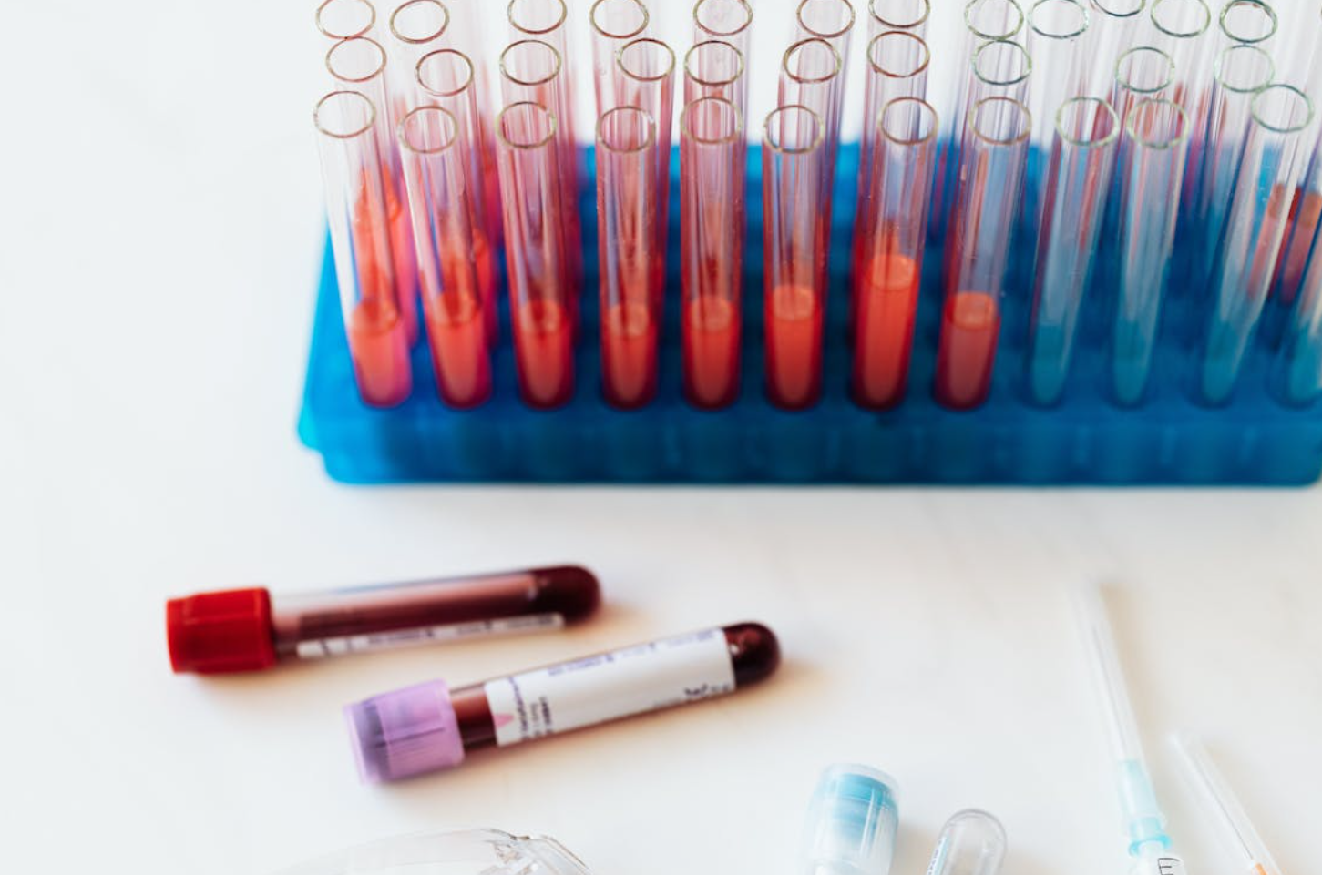 Read more about the article Transferrin Saturation(트렌스페린 포화도) 검사 진짜 빈혈을 찾아내는 척도
