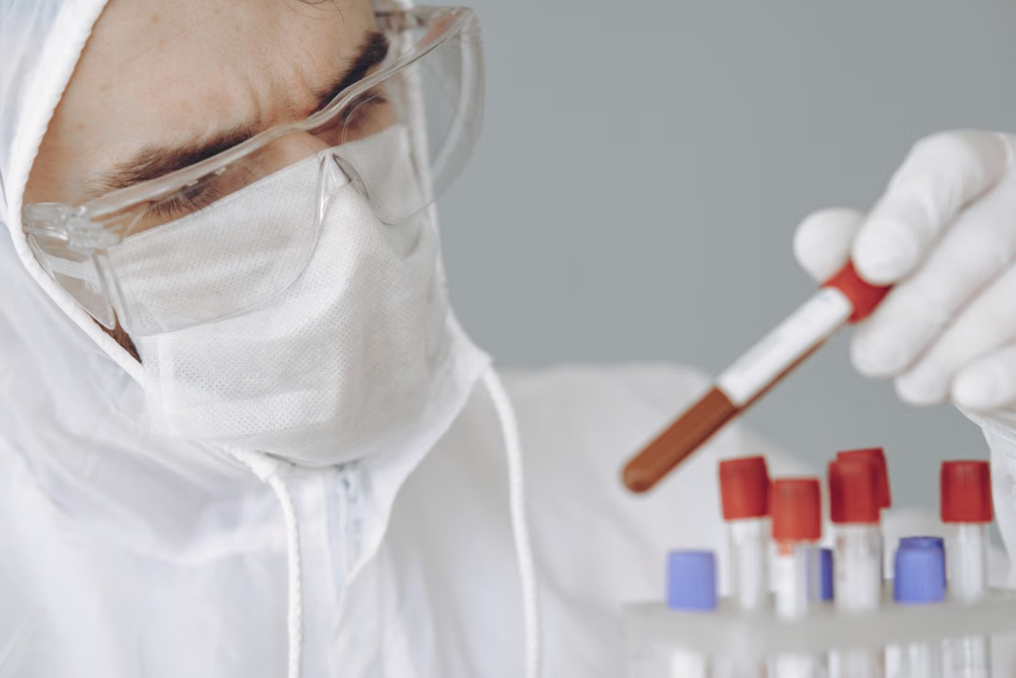 Read more about the article N-Methylformamide (NMF) 검사 DMF 간 독성 노출 지표 및 판독 노하우