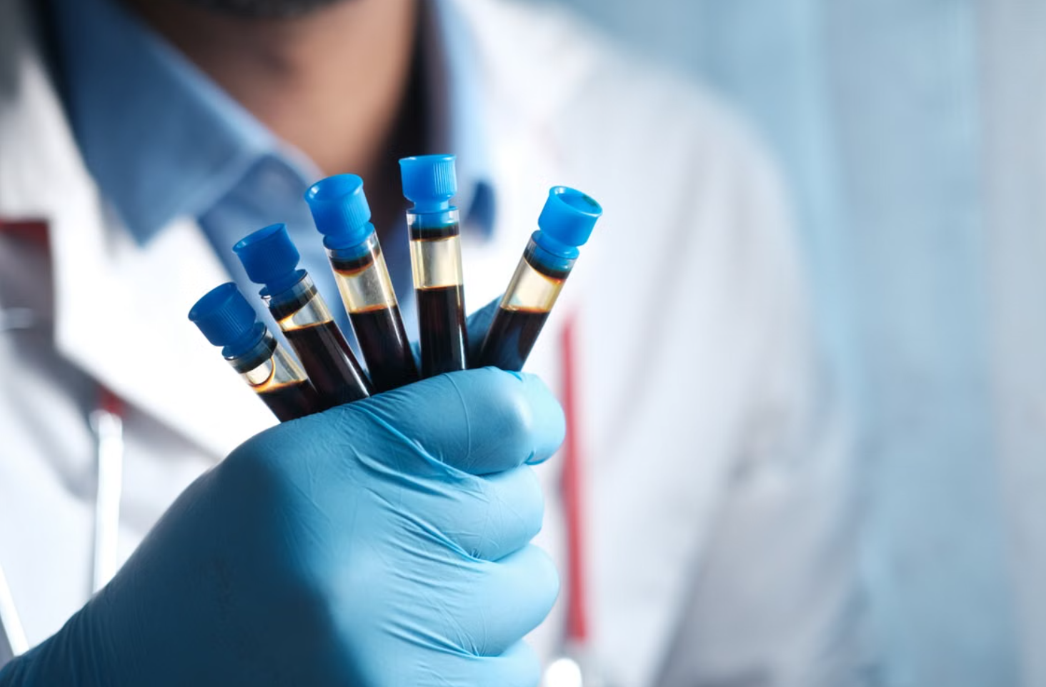 Read more about the article 1,2-Dichloropropane(1,2-DCP) 특수건강검진 생물학적 모니터링: 담관암 예방과 대사체 판독법