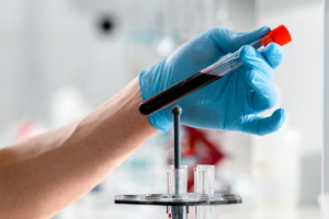 Read more about the article Methylhippuric acid (메틸마뇨산) 검사 크실렌(Xylene) 노출 지표와 중추신경계 독성 방어