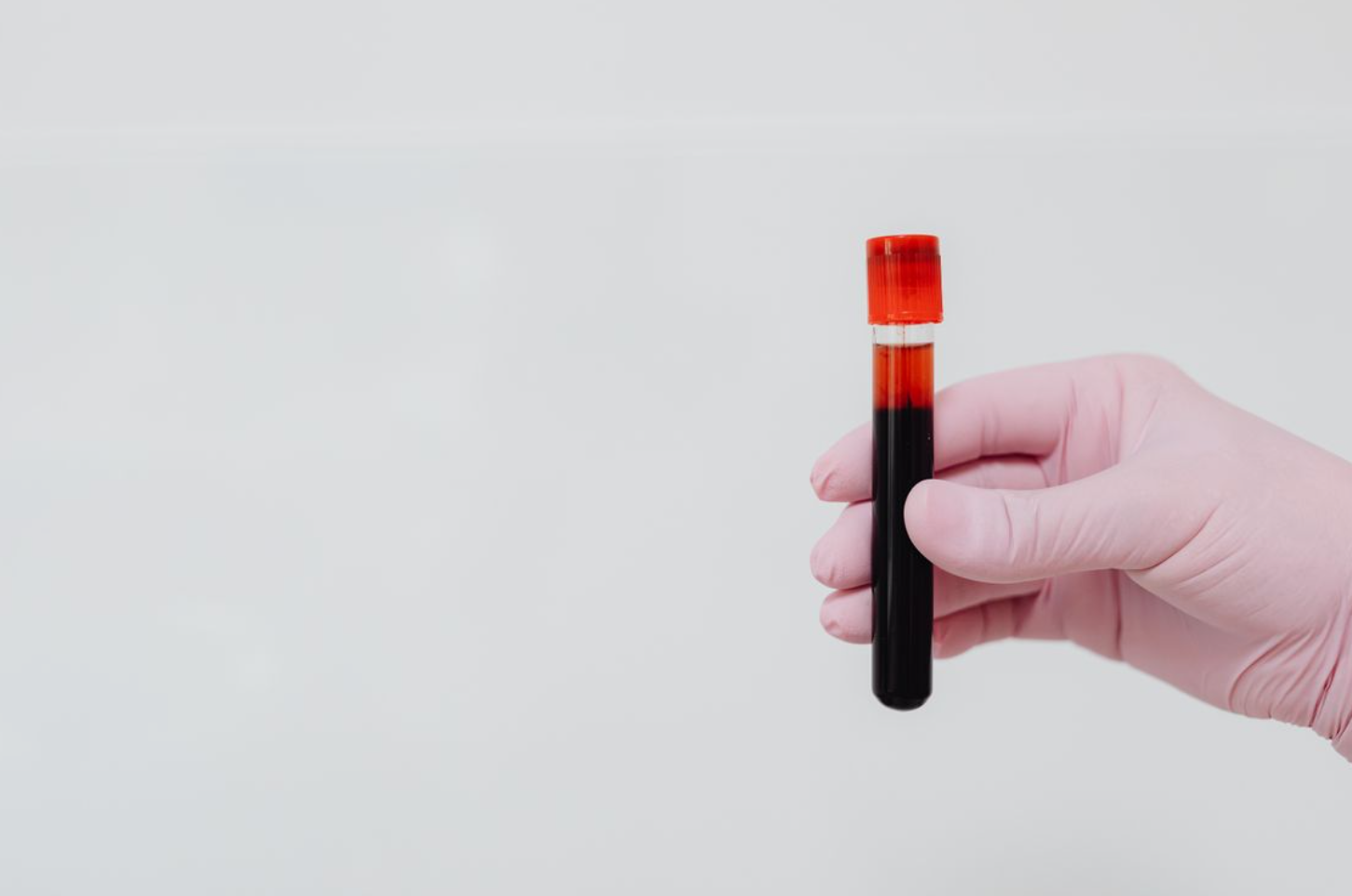 Read more about the article SARS-CoV-2 Ab(코로나19 항체)’ 정량 검사 체내 면역 방어선의 지도