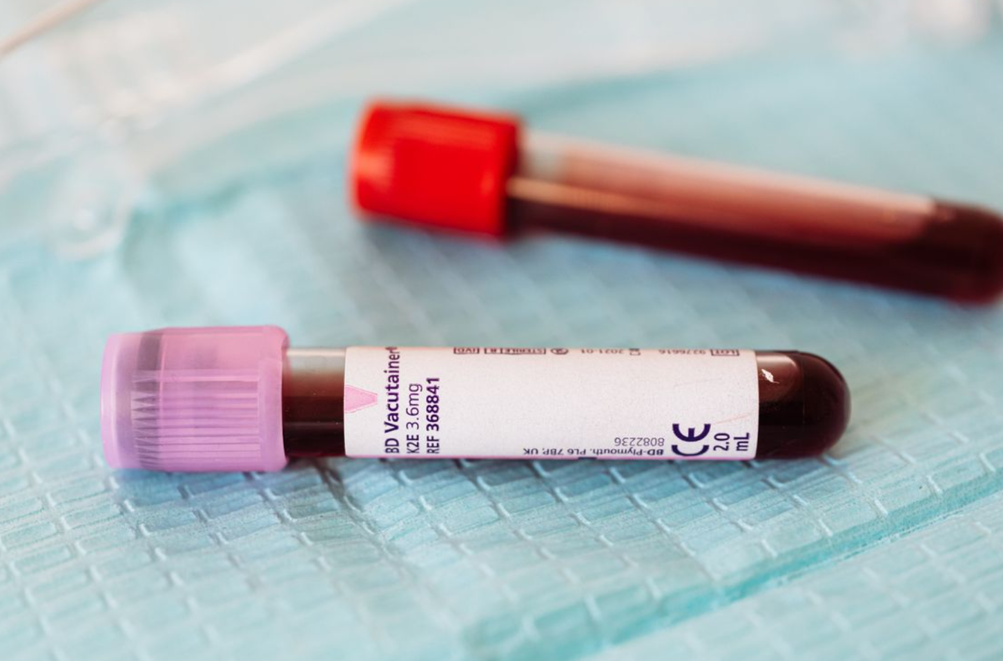 Read more about the article o-Cresol 검사 톨루엔(Toluene) 노출 지표와 신경·신장 독성 판독법