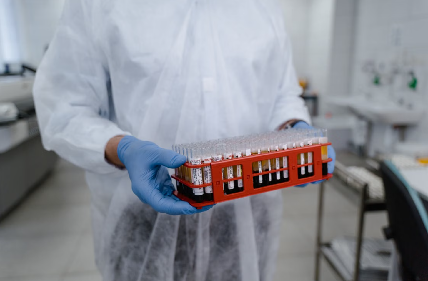 Read more about the article Parasite Ab IgG (간흡충) 검사 소화기계 기생충 감염의 고정밀 혈청학적 진단 가이드